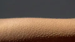 Neurobiologinen ilmiö: miksi iho menee kananlihalle?