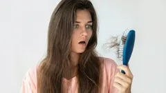 Tietyt ruoat ja juomat voivat edistää hiustenlähtöä, tutkimus kertoo