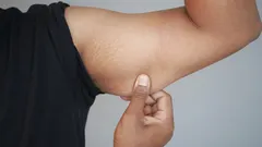 Näin pääset eroon veltoista käsivarsista kotiharjoittelulla: yksinkertaiset vinkit, jotka voit ottaa käyttöön jo tänään