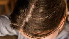 Rasvaiset hiukset: 7 käytännön vinkkiä, joilla saat vastapestyjen hiusten tunteen kestämään